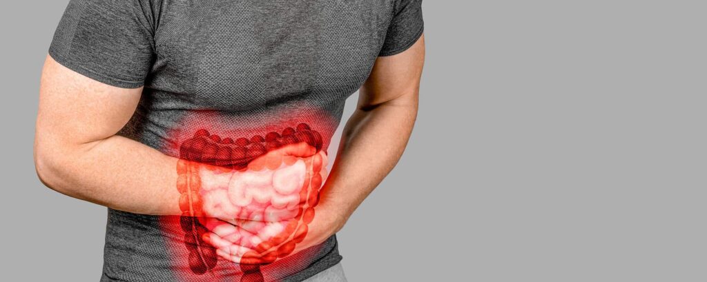 doença de Crohn o que é