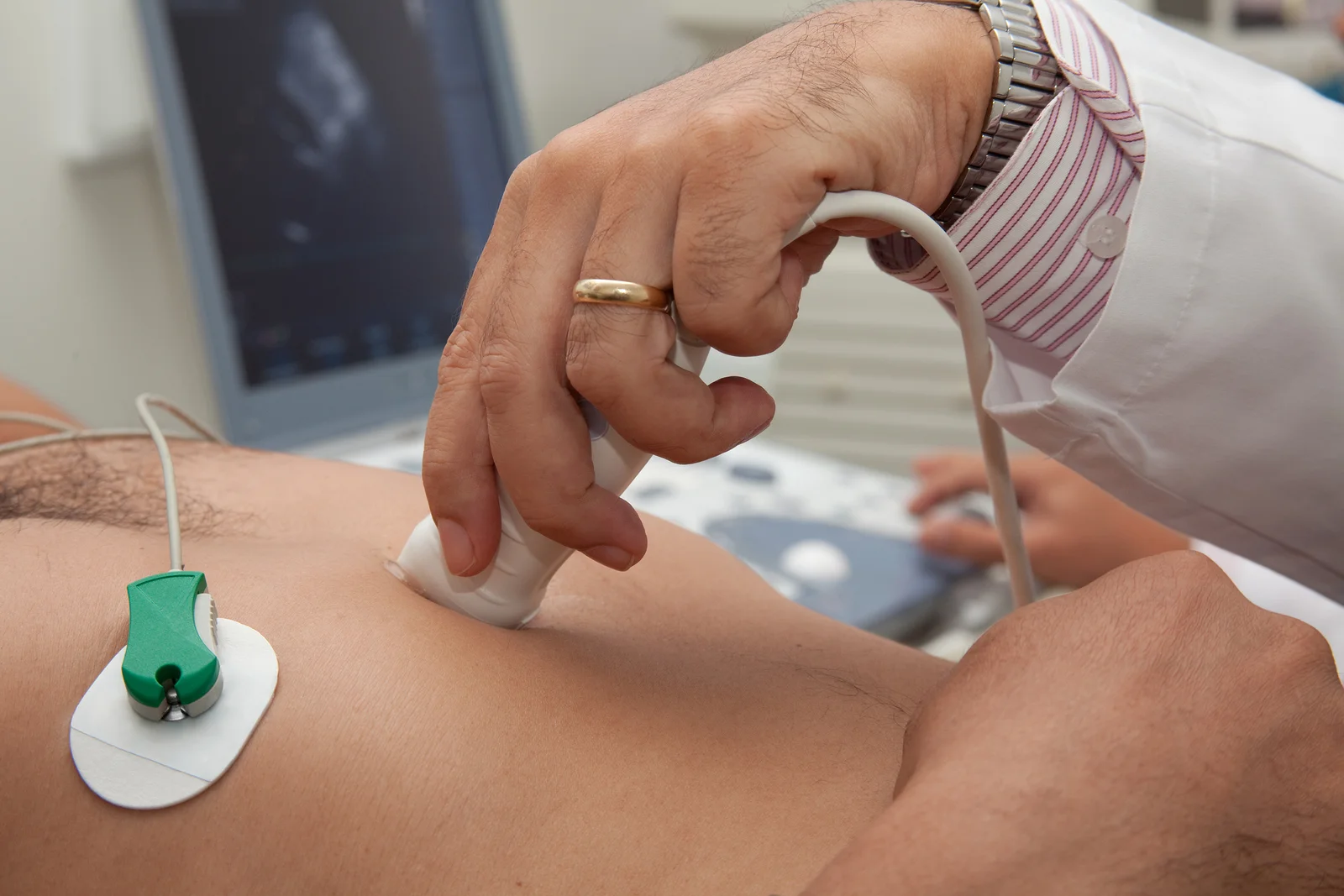 Ecocardiograma transtorácico bidimensional com Doppler colorido