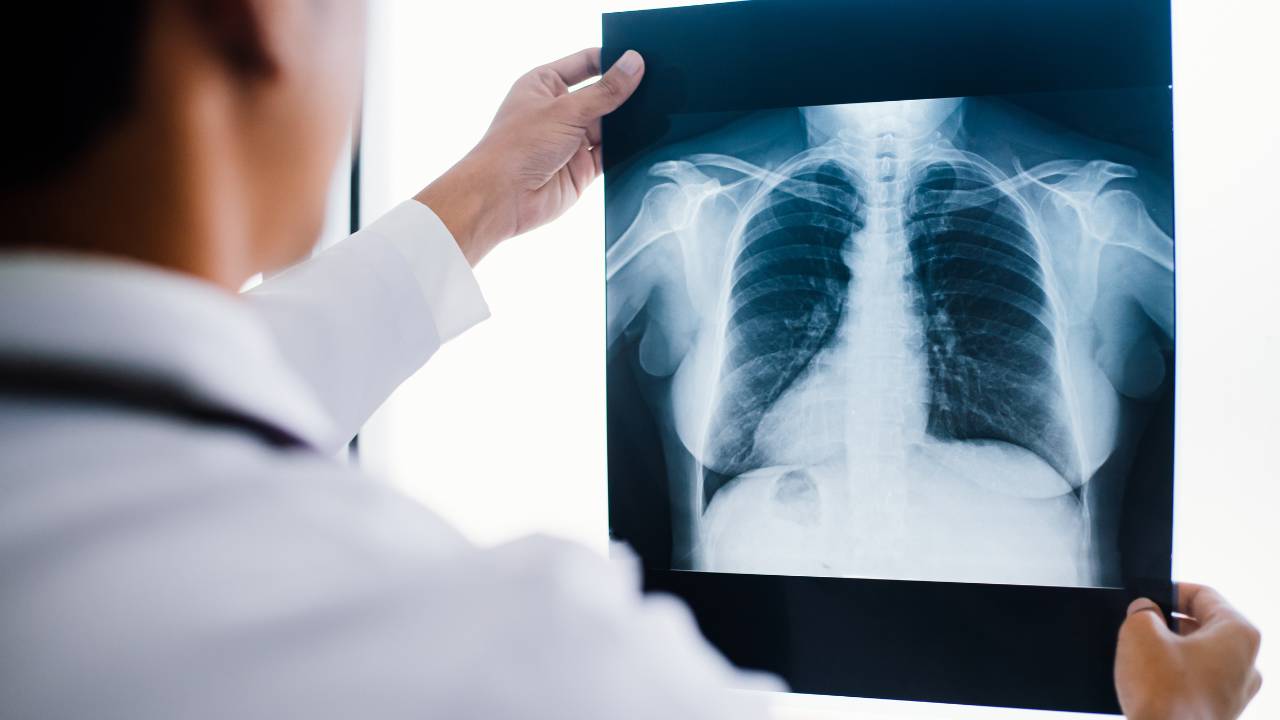 Radiografia de tórax sendo avaliada por médico especialista em diagnóstico por imagem