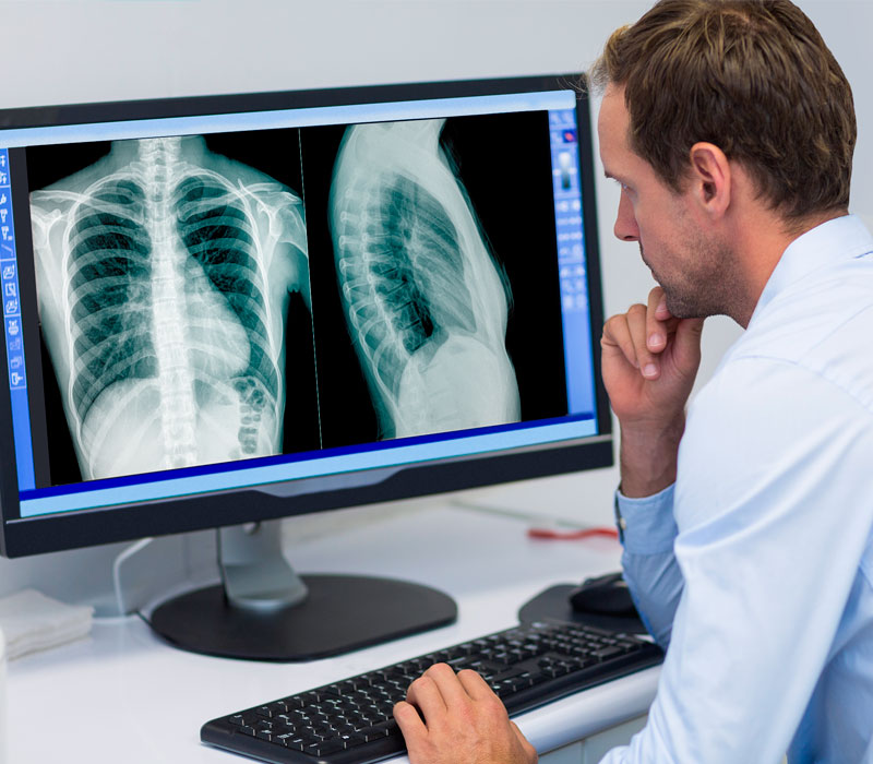 Técnico em radiologia posicionando paciente para exame de raio-X na Casa da Esperança