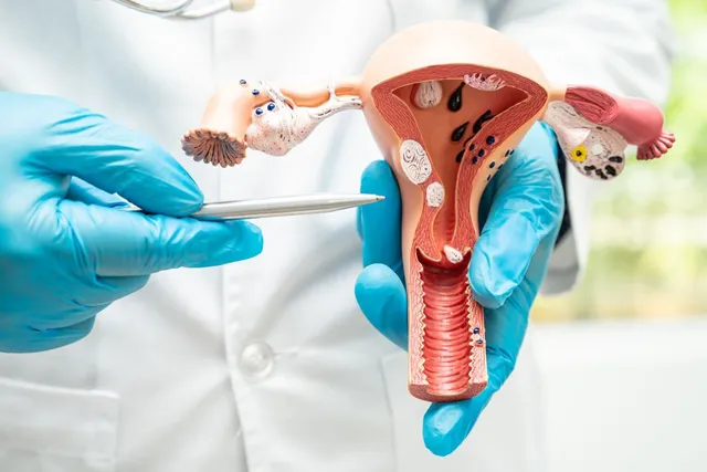 Médico segurando modelo anatômico do útero e ovários, estruturas avaliadas no ultrassom transvaginal